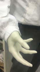 ナノダックス（nanodax）の３Dプリンターで制作した義手